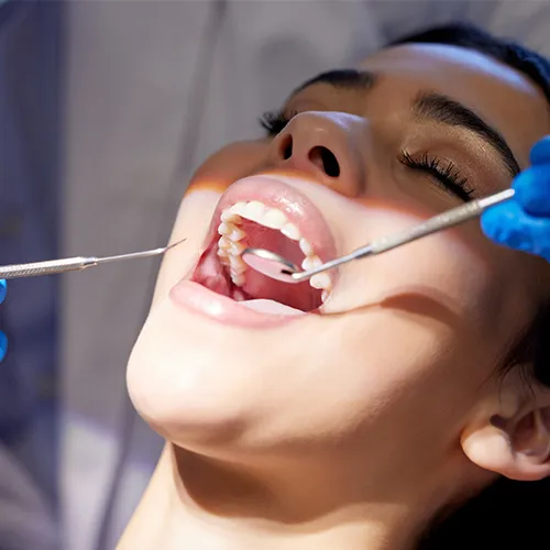 Gloved hands using dental tools in woman's mouth.
