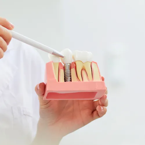 Hand holding tool pointing at implant between teeth in gum model held in other hand.