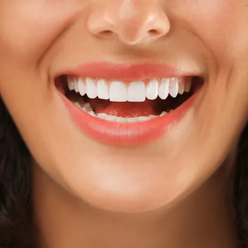 Woman smiling.