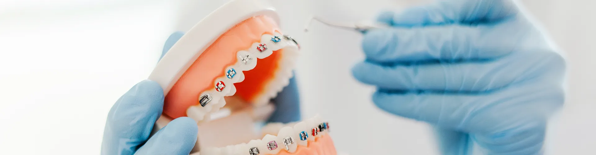Close-up of a dental model with colorful braces, demonstrating orthodontic care and teeth alignment.