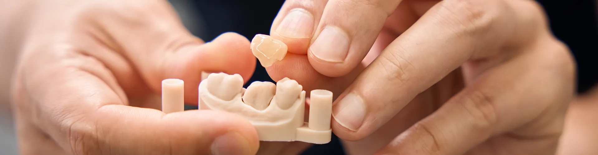 hands removing a dental crown from a tooth model