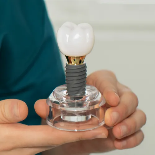 Dentist holding a dental implant model with a titanium post and ceramic crown, demonstrating how dental implants replace missing teeth with a natural-looking, permanent restoration.
