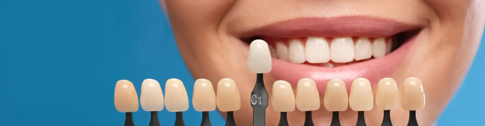 Tooth shade-matching tool in front of woman's smile.