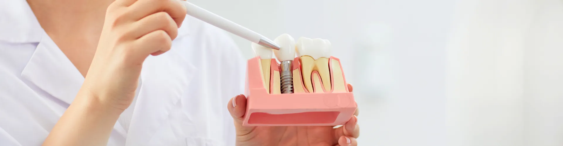 Hand holding tool pointing at implant between teeth in gum model held in other hand.
