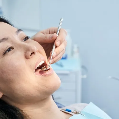 Dentist using a dental mirror to examine a patients teeth for cavity fillings.