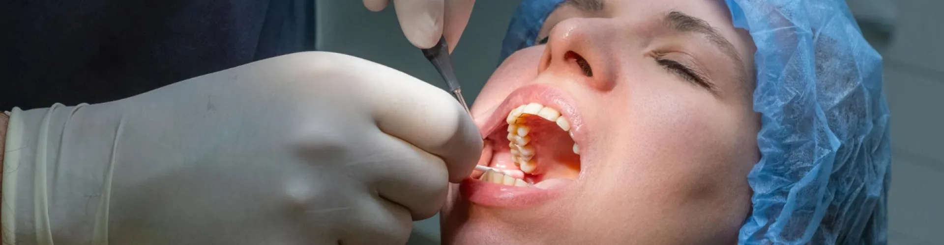 Gloved hands using dental tools in patient's mouth.