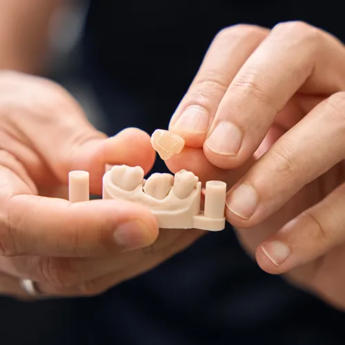 hands removing a dental crown from a tooth model