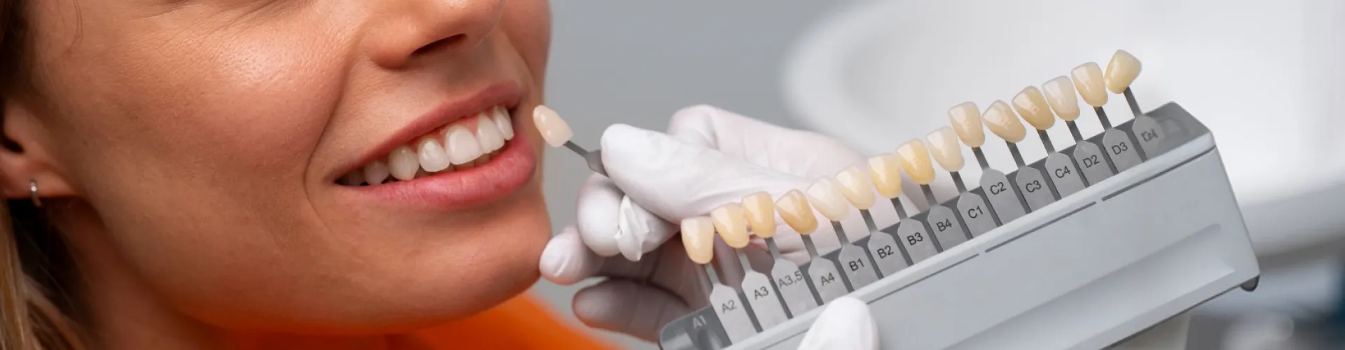 Dentist using a dental shade guide to match veneers or bonding for a patient.
