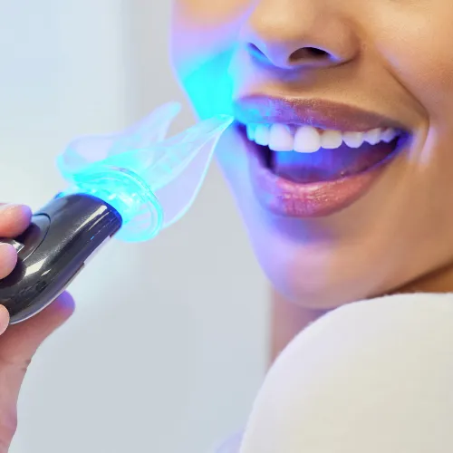 Woman shining whitening led light on her smile.